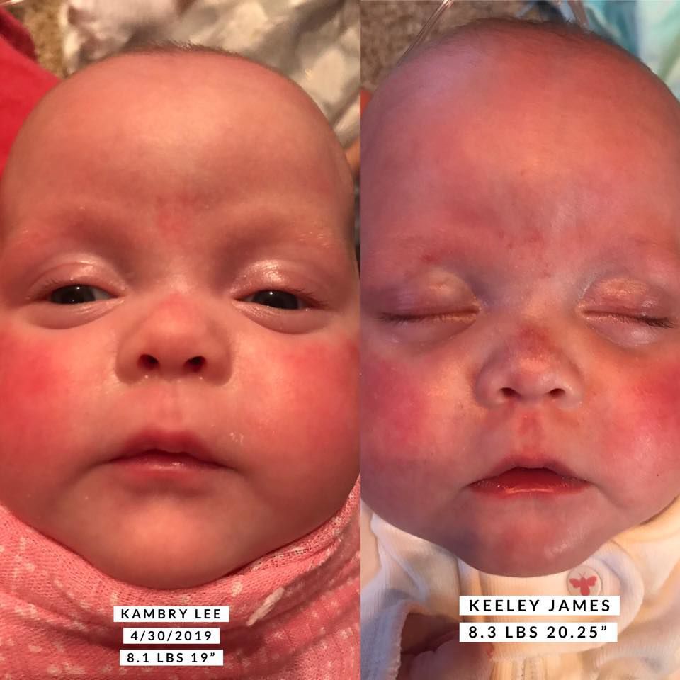 Twins at 5 months